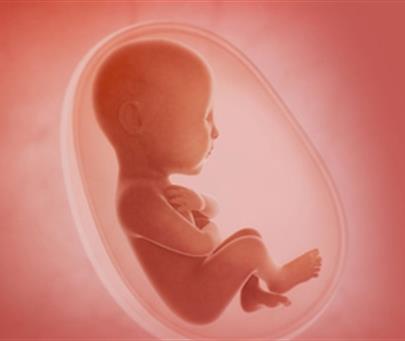 Genetic  test of the aborted fetus or death neonatal